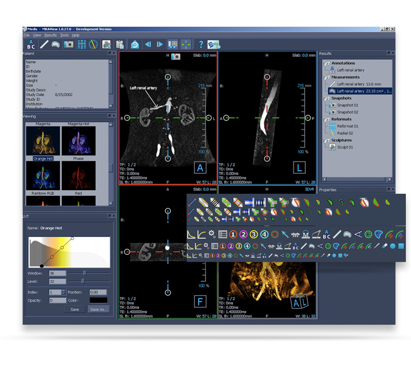 UI Design - Medis Medical Imaging